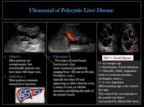 Pin By June Bug On Ultrasound Medical Ultrasound Ultrasound