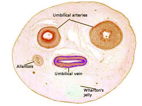 Figure Umbilical Cord Image Courtesy S Bhimji Md Statpearls Ncbi