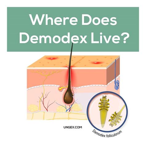 Demodex Mites Life Cycle Food And Remedy Demodex Demodex Mites