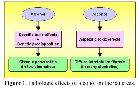 Alcohol And Chronic Pancreatitisleading Or Secondary Etiopathoge