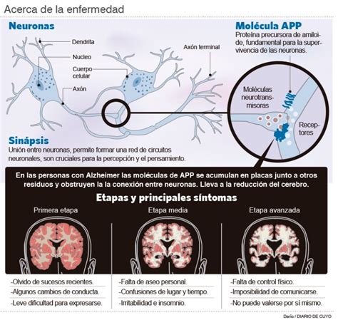 La Ciencia Empieza A Entender El Alzhéimer Diario De Cuyo Noticias