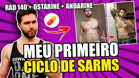 Rad 140 Antes E Depois