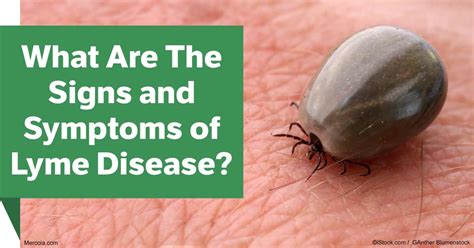 What Are The Signs And Symptoms Of Lyme Disease