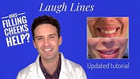 Laugh Lines: Myths & Truths (Updated Tutorial) - YouTube