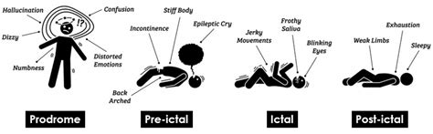 Predicting Epileptic Seizure Onsets With Heart Rate Variability Hrv