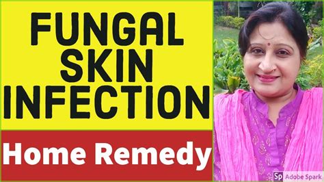 Skin Fungal Infection Treatment Skin Infection How To Cure Skin