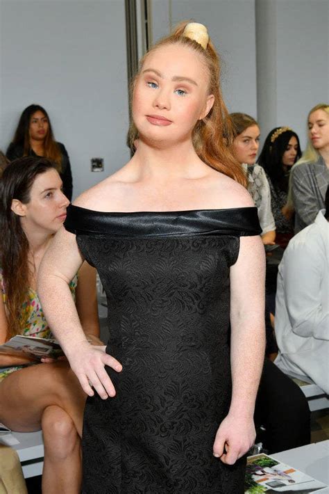 The Worlds Most Famous Model With Down Syndrome Plans To Be A Victoria Secret Angel