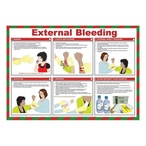 External Bleeding First Aid Posters 590mm X 420mm From Key Signs Uk