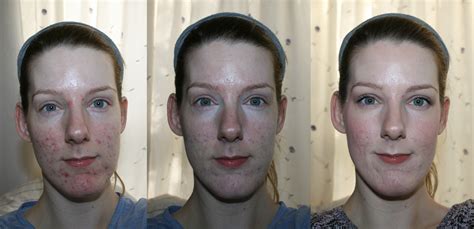 Glominerals Corrective Camouflage Kit Before And After Beauty Geek Uk