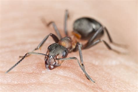 Ant Bites Pictures Treatment And Home Remedies Symptoms