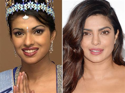 Priyanka Chopra Before And After Before Vs After Rostros