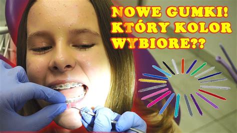 Nowe Gumki W Aparacie Na ZĘby 🤩 Wizyta U Ortodonty 😩 BolaŁo Vlog