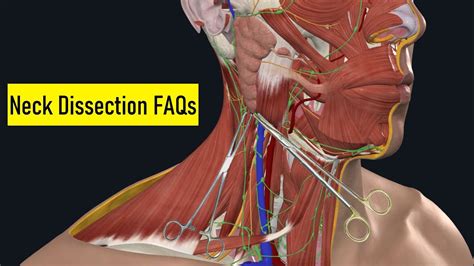 Neck Dissection Surgical Anatomy Or Faqs And Answers 201 Didactic