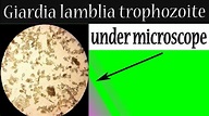 Giardia lamblia trophozoite under microscope (In stool sample) - YouTube