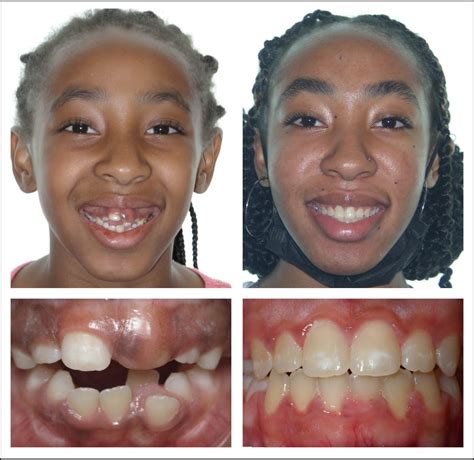 Philadelphia Orthodontist Cosmetic Dentistry In Philadelphia