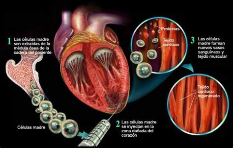 Células Madre Y Regeneración Cardiovascular