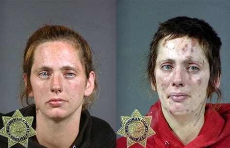 from drugs to mugs shocking before and after images show the cost of drug addiction telegraph