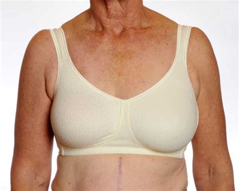 External Breast Prostheses Cancer Australia