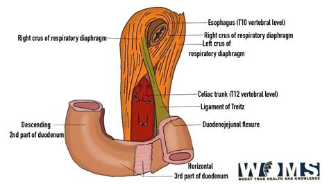 Ligament Of Treitz An In Depth Look At Its Anatomical Significance Woms
