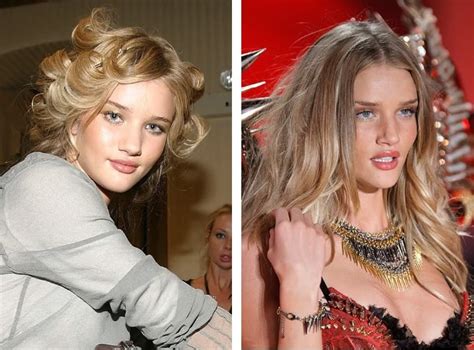 Rosie Huntington Whiteley Before And After Plastic Surgery Lips Nose