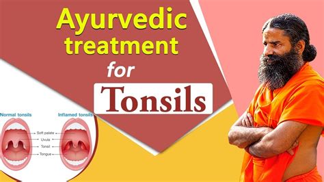 Ayurvedic Treatment For Tonsil Swami Ramdev Youtube