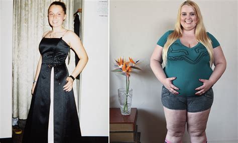 Tammy Jung Feeds On Calories A Day Through A Funnel In Hope To Become An Obese