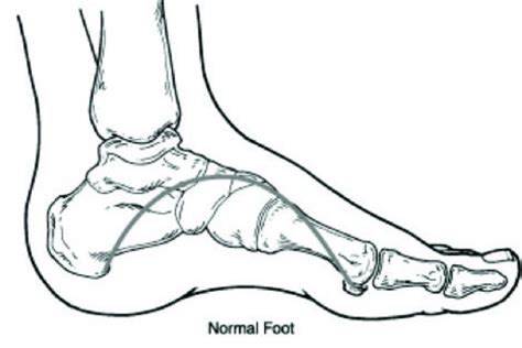 Dont Ignore Flat Feet Oakleaf Medical