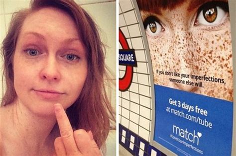Advert Calling Freckles Imperfections Pulled After Backlash
