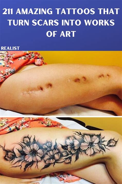 211 Amazing Tattoos That Turn Scars Into Works Of Art Scars Tattoo