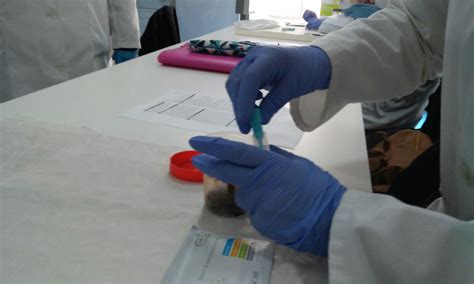 prácticas bioquímica sangre oculta en heces nadal fob test