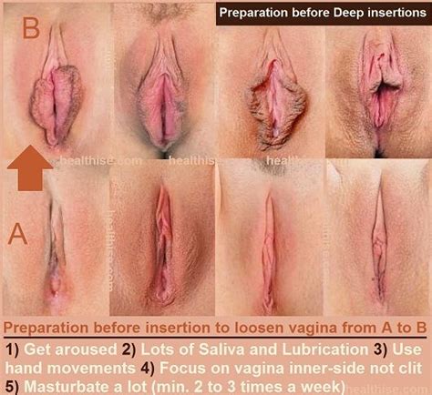 Close Up Spread Open Vaginas Telegraph