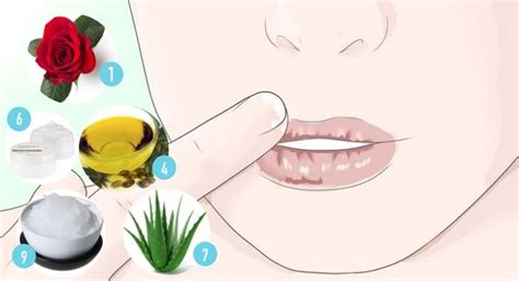 10 Effective Home Remedies For Dry Cracked Lips Fitneass