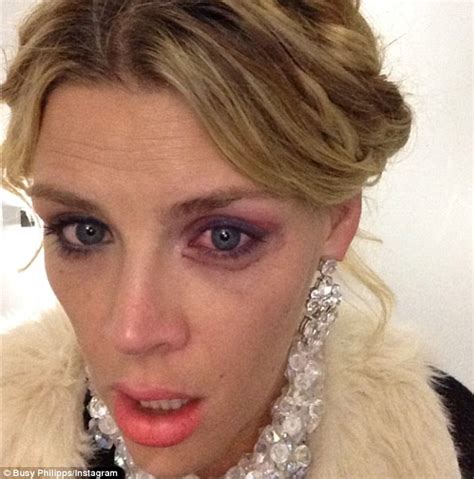 Busy Philipps Gets Black Eye On Set Of Cougar Town Photo The