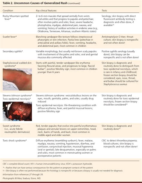 Table 2 From The Generalized Rash Part I Differential Diagnosis