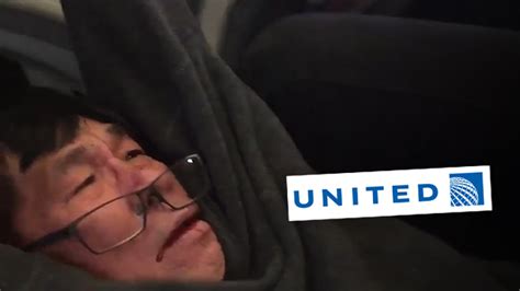 United Airlines Settles With Dr David Dao For Savagely Dragging Him