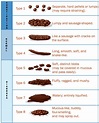 understanding the meaning of different stool colors what your poop ...