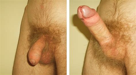 3 In Gallery Flaccid Vs Erect Penis Picture 3 Uploaded By Oil Of