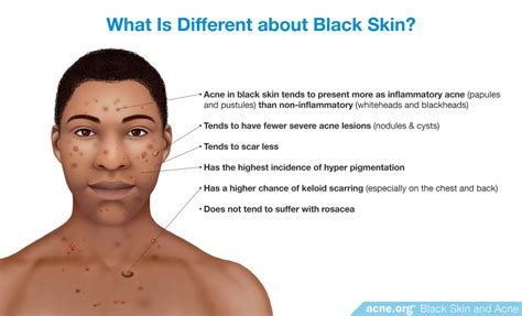 Black Spots On African American Skin