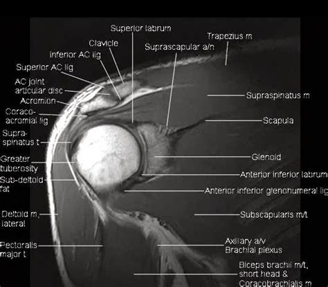 This mri knee cross sectional anatomy tool is absolutely free to use. Pin on Medical