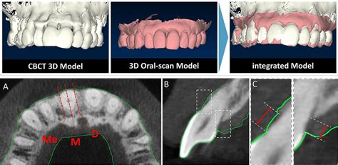 Cone Beam Computed Tomography Cbct Images Were Acquired And
