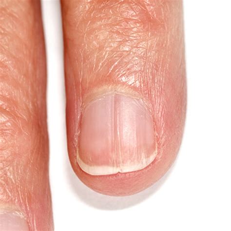 7 Weird Things That Can Happen To Your Finger Nails Better Homes And