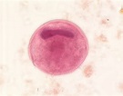 Balantidium coli cyst | Parasitology | Pinterest