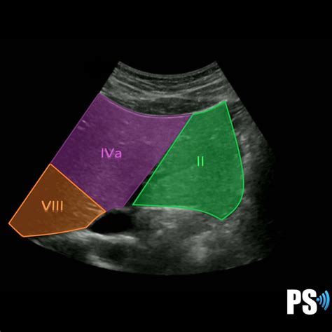 Couinauds Liver Segments Sonographic Tendencies Segmentation Ultrasound Technician