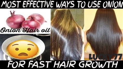 Most Effective Ways To Use Onion For Fast Hair Growth Youtube