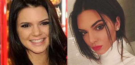 Let's see how her appearance and styles have. How real are the Kardashians? Kendall Jenner plastic ...