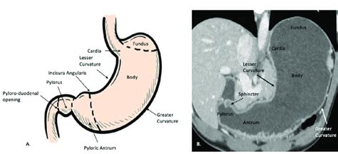 Gastric Anatomy A Schematic Illustration B Coronal Download