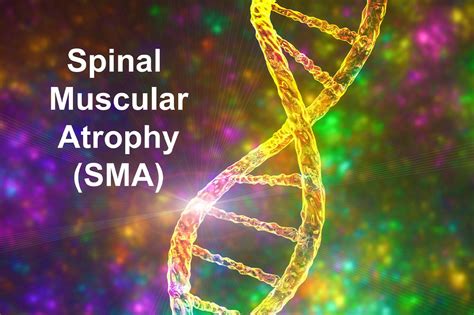 Types Signs And Diagnosis Of Spinal Muscular Atrophy