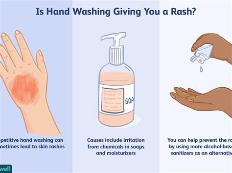 Allergic Reaction Winter Rash On Hands