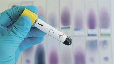 Unprotected Sex Behind Record Rise In Hiv Cases