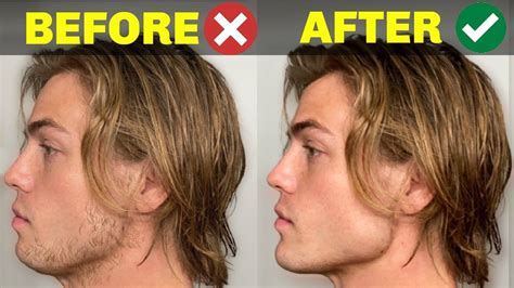 5 Things You Do That Are Ruining Your Jawline Perfect Jawline Chiseled Jaw Jawline